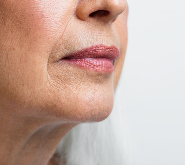 დერმატოლოგია